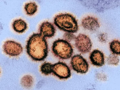 Phát hiện các virus cổ đại bị "đóng băng" 14.400 năm chưa từng được biết đến