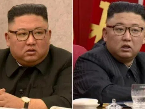 Tình báo Hàn Quốc hé lộ thông tin về tình trạng sụt cân của ông Kim Jong-un