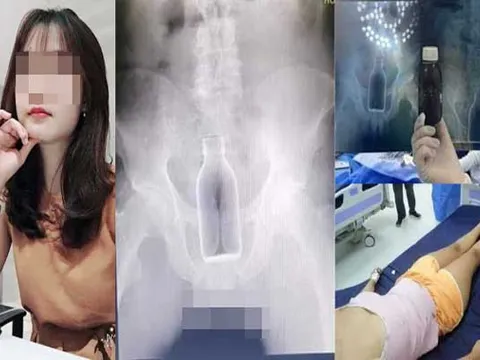 Chồng đi công tác, vợ ở nhà dùng chai, lọ "tự sướng" đến nhập viện