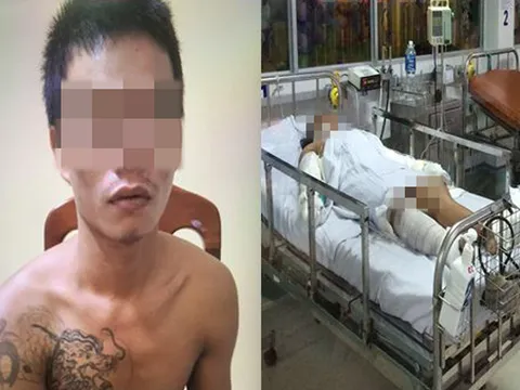 Say rượu, con trai tưới dầu đ.ố.t cha nguy kịch