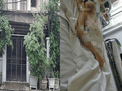 Vụ người phụ nữ bị kẻ lạ nghi tạt axit ở Nghệ An: Bỏng cơ thể, mắt hỏng 8 phần