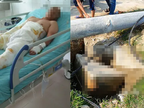 Người đàn ông Nghệ An bị điện giật có gia cảnh khó khăn cần sự giúp đỡ của cộng đồng