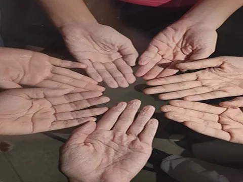 Chuyện về những đôi bàn tay, bàn chân trắng bệch vì “ngâm mồ hôi” của y bác sĩ nơi tuyến đầu