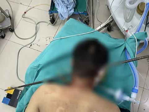 Cứu sống nam thanh niên bị thanh sắt xuyên từ cổ qua não