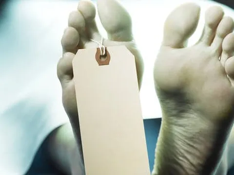 Mẹ con chủ nhà tang lễ ở Mỹ bán tử thi kiếm lời