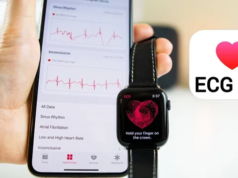 Apple Watch giúp bệnh nhân kịp thời phát hiện ra khối u