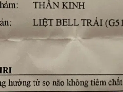 Bác sĩ ĐH Y Dược TP HCM lý giải về căn bệnh liệt mặt mà Hari Won đang mắc phải