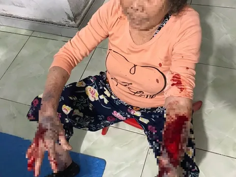 Góp ý hàng xóm hát karaoke quá to, cụ bà 83 tuổi bị đánh nhập viện