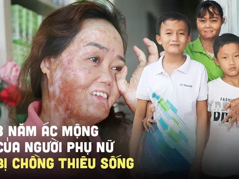 Người phụ nữ bị chồng tưới xăng thiêu sống, bỏng 92%: "3 năm qua giống như một cơn ác mộng, em đau lắm nhưng phải sống vì con"