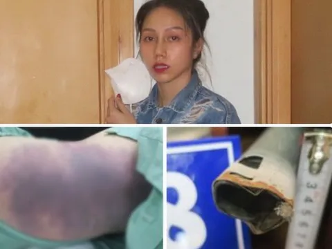 Vụ cháu bé 8 tuổi tử vong: "Dì ghẻ" nhốt bé cùng chó và bắt quỳ gối trong chuồng chó