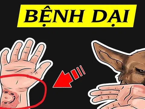 Bộ Y tế cảnh báo nguy cơ bùng phát bệnh dại