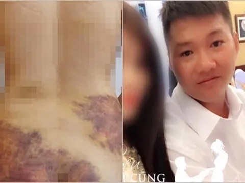 Vụ vợ tố chồng b-ạo h-ành, ép q-uan h-ệ: Người chồng bất ngờ "phản pháo"