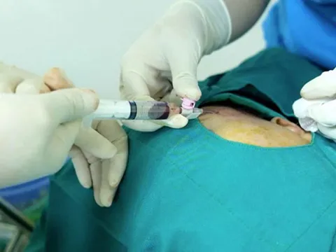 Nam bệnh nhân độn thái dương bị chảy máu phải đi cấp cứu