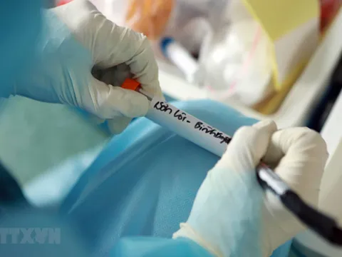 Khoảng 30 địa chỉ ở Việt Nam có thể xét nghiệm COVID-19