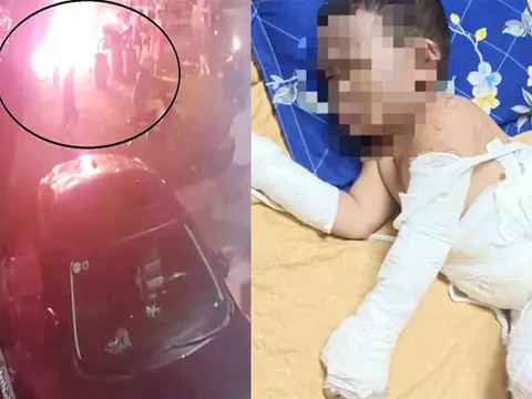 Phẫn nộ nhóm côn đồ ném "bom xăng" khiến 2 trẻ bỏng nặng