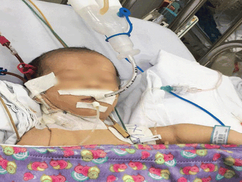 Bé sơ sinh 3 ngày tuổi đột ngột hôn mê do bệnh hiếm gặp, cha mẹ cần lưu ý