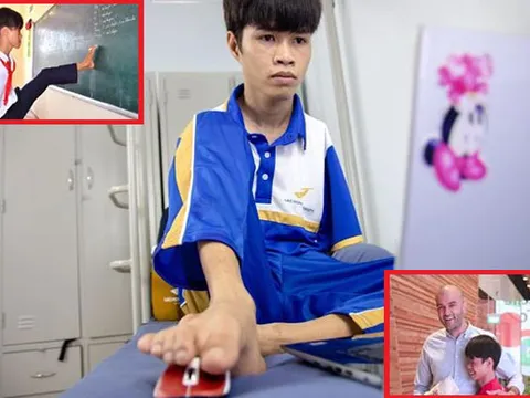 Cậu bé "chim cánh cụt" không tay, dùng chân viết chữ nổi tiếng một thời nay đã là sinh viên, được mời vào Google làm việc