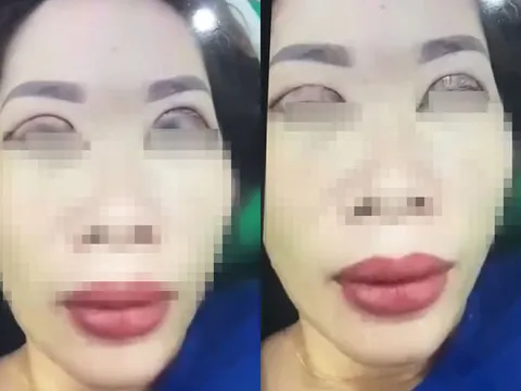 Một pha cắt mí "đi vào lòng người" khi nữ khách hàng bây giờ "khóc không được, cười cũng không xong"