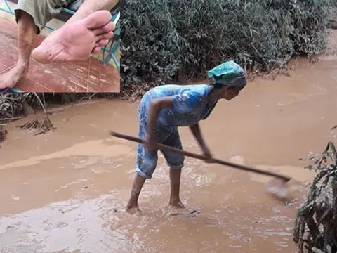 Những đôi chân ứa máu của người dân vùng lũ