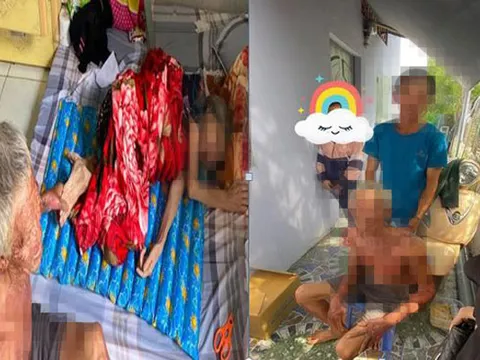 Con trai cụ ông bị bỏng nặng 10 năm mới về thăm cha, rồi rời đi cùng 110 triệu đồng tiền từ thiện của cha: Tắt điện thoại không thể liên lạc