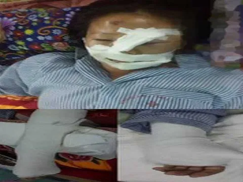 Hành hung vợ dã man: "Tao đâm mù mắt, cắt lưỡi, cắt gân xem mày làm được gì"