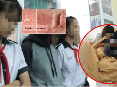 Đau lòng hai nữ sinh lớp 7 "yêu" chung bạn trai, người dính bầu, người mắc sùi mào gà
