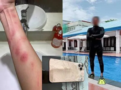 Mượn tiền bạn gái không trả, chàng thanh niên còn bạo hành, uy hiếp và đe dọa đăng ảnh nhạy cảm lên mạng